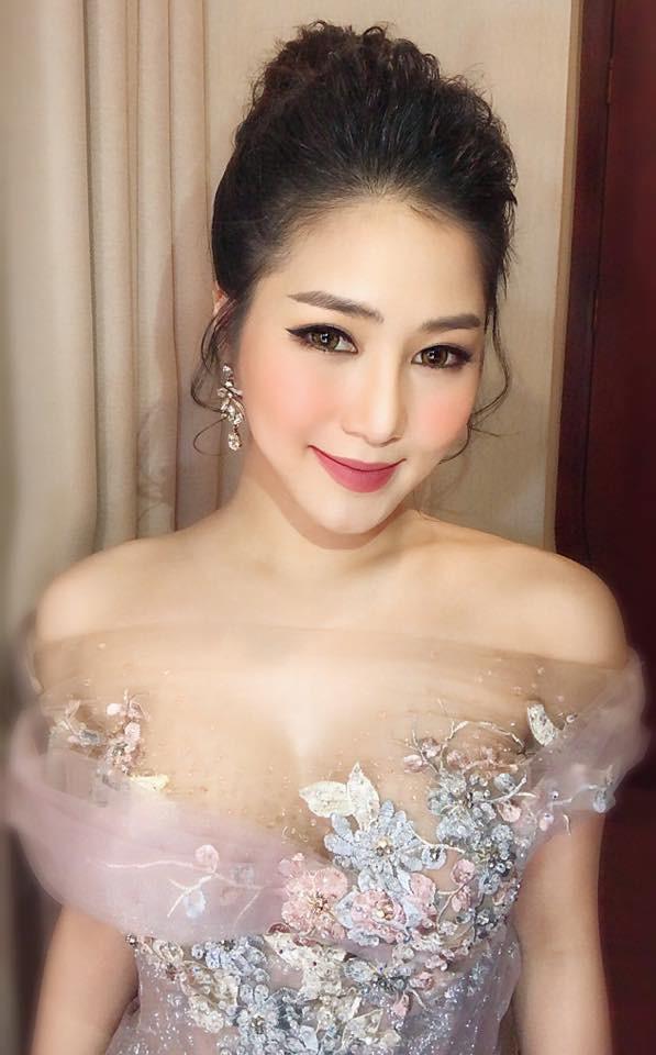 Ca sĩ Hương Tràm gần như bị mất thị giác, đi lại phải có người dìu