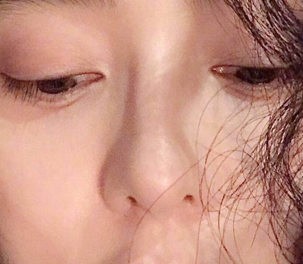 Được coi là nữ thần nhưng Phạm Băng Băng lại bị phát hiện lộ dấu vết dao kéo? Được coi là nữ thần nhưng Phạm Băng Băng lại bị phát hiện lộ dấu vết dao kéo?