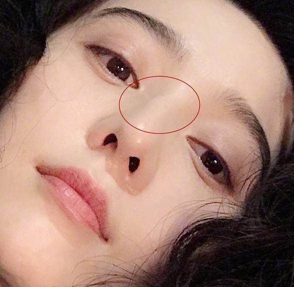 Được coi là nữ thần nhưng Phạm Băng Băng lại bị phát hiện lộ dấu vết dao kéo?