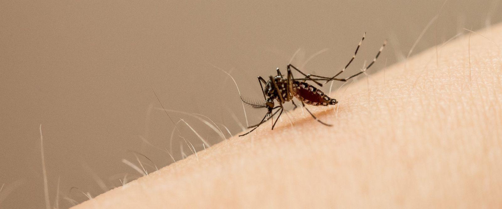 Cách trị sẹo thâm ở chân bằng nguyên liệu từ thiên nhiên!