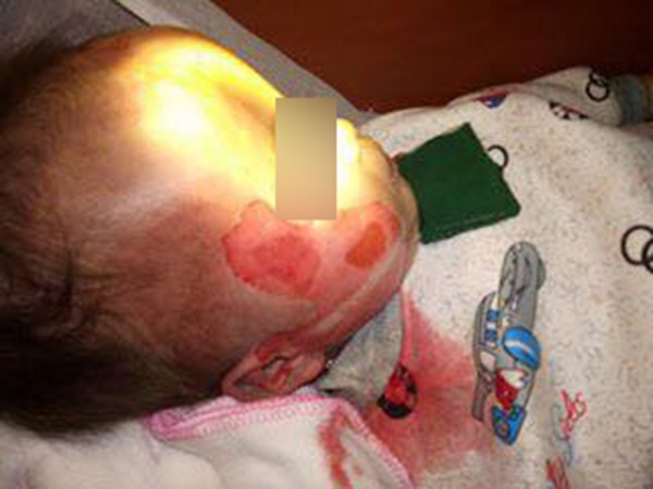 Bé trai tử vong trên người có nhiều vết thương lạ sau khi cấp cứu tại bệnh viện?