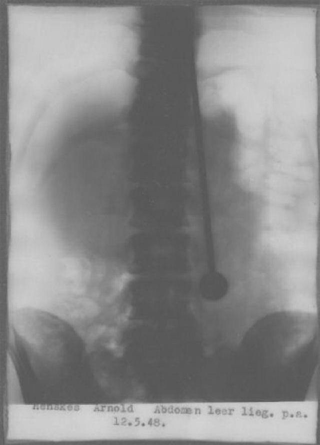 Đâm kiếm xuyên qua lồng ngực tới 500 lần, người đàn ông vẫn bình an vô sự một cách bí ẩn