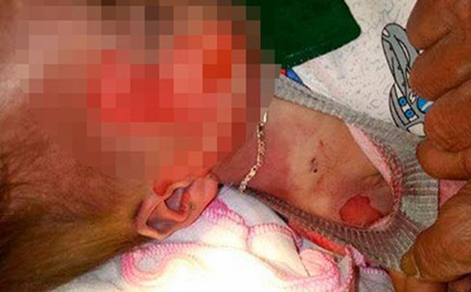 Vụ bé trai 15 tháng tuổi tử vong, người có nhiều vết thương: Bộ Y tế yêu cầu làm rõ