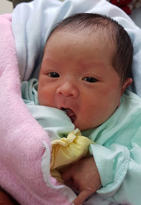 Kỳ diệu sản phụ sinh đôi, 1 bé gái còn nguyên trong bọc ối