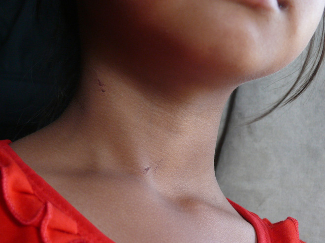 Bố tâm thần, nhậu say rồi đi về để con gái 10 tuổi ở lại nghi bị hàng xóm hiếp dâm trong đêm