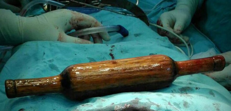 Hai ngày kinh hoàng của người vợ bị chồng nhét cả chày vào bụng vì vô sinh