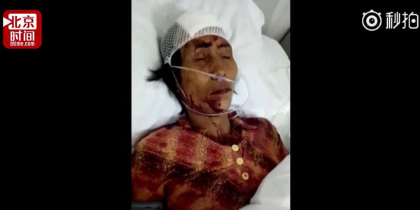 Lao công bị đánh chảy máu đầu vì vô tình làm bẩn giày của nữ khách