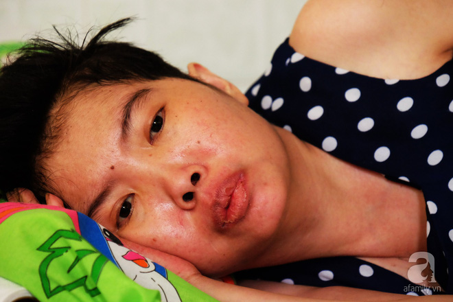 Vì tình yêu, người đàn ông tự tay chăm sóc vợ hờ mang bệnh hiểm nghèo chảy máu vùng kín, thương con vợ như con mình