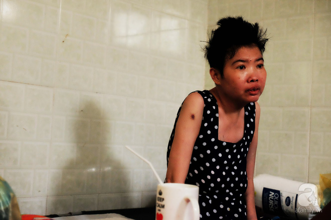 Vì tình yêu, người đàn ông tự tay chăm sóc vợ hờ mang bệnh hiểm nghèo chảy máu vùng kín, thương con vợ như con mình