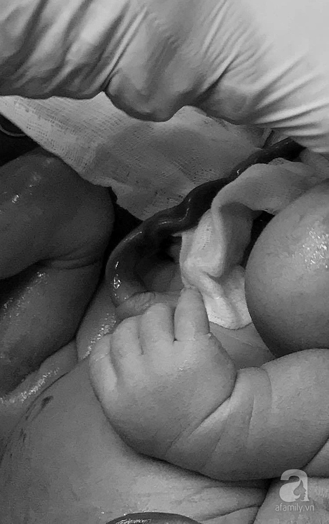 Cần Thơ: Sản phụ 29 tuổi suýt mất con vì tình trạng tắc mạch rốn trong tử cung rất hiếm gặp