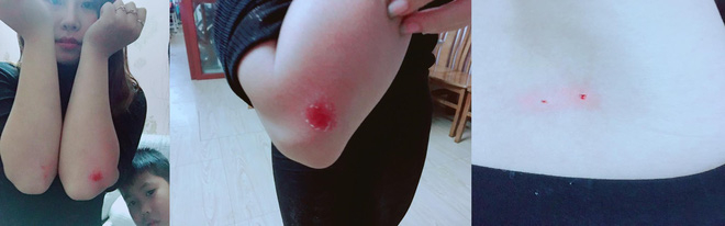 Cô gái liều mình cứu chó khiến dân mạng cảm động: Bọn trộm chó không xong với tôi đâu!