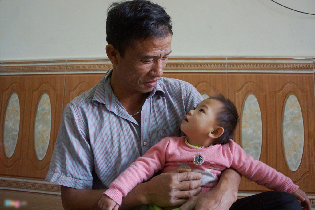 Bé sơ sinh suýt bị chôn sống hồi sinh kỳ diệu sau 2 năm