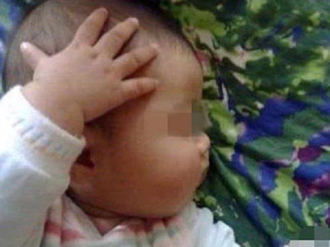 Con liên tục đưa tay lên gãi đầu, bố mẹ cho rằng đó là cử chỉ hết sức bình thường nhưng rồi nhận ra sự thật đáng sợ