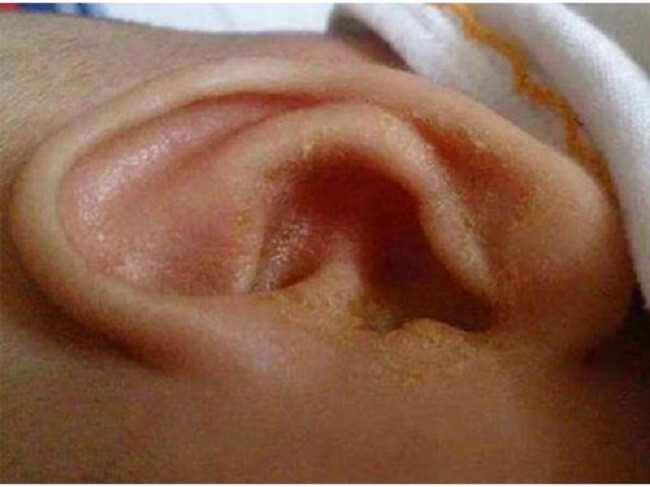 Con liên tục đưa tay lên gãi đầu, bố mẹ cho rằng đó là cử chỉ hết sức bình thường nhưng rồi nhận ra sự thật đáng sợ