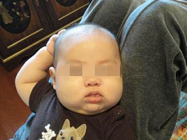 Con liên tục đưa tay lên gãi đầu, bố mẹ cho rằng đó là cử chỉ hết sức bình thường nhưng rồi nhận ra sự thật đáng sợ