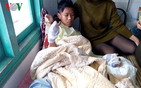 Một thiếu niên mất hai bàn tay vì pháo nổ