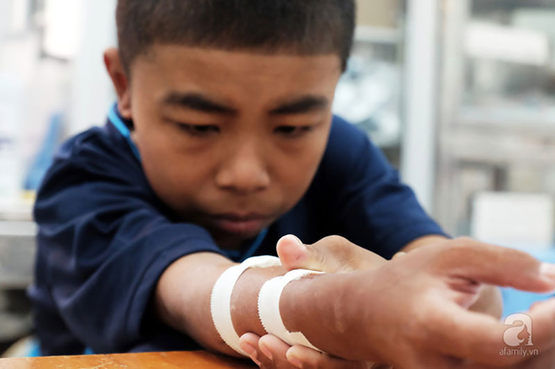 Tết trong bệnh viện của những đứa trẻ chạy thận: Tay sưng vù vì vết kim châm