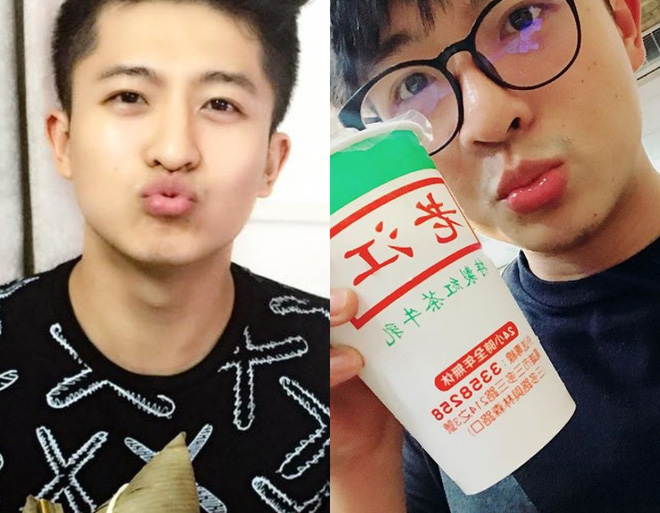 Diện mạo của Harry Lu sau tai nạn: Làm lại mũi thôi mà trông khác hẳn!