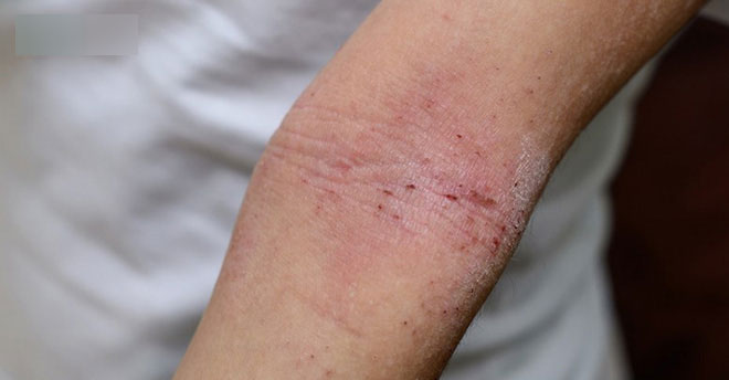 Gặp phải 5 dấu hiệu này, bạn nên đi kiểm tra thận càng sớm càng tốt