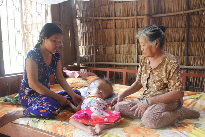 Phép màu kỳ diệu đến với cặp vợ chồng trẻ nuôi con gái 4 tuổi bị não úng thủy, đầu to gấp 3 lần trong năm mới