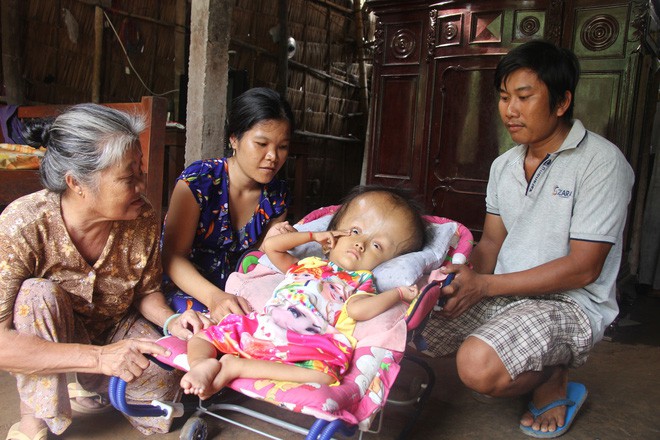 Phép màu kỳ diệu đến với cặp vợ chồng trẻ nuôi con gái 4 tuổi bị não úng thủy, đầu to gấp 3 lần trong năm mới