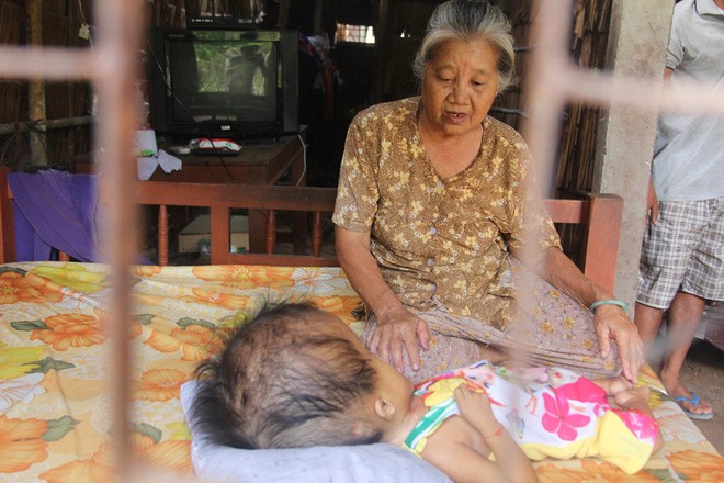 Phép màu kỳ diệu đến với cặp vợ chồng trẻ nuôi con gái 4 tuổi bị não úng thủy, đầu to gấp 3 lần trong năm mới