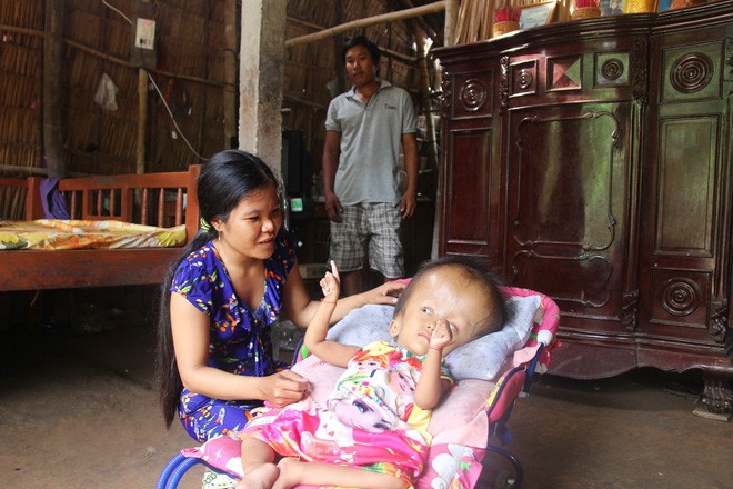 Phép màu kỳ diệu đến với cặp vợ chồng trẻ nuôi con gái 4 tuổi bị não úng thủy, đầu to gấp 3 lần trong năm mới