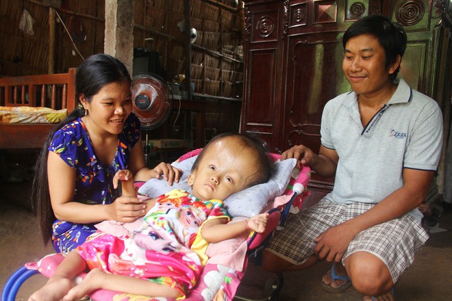 Phép màu kỳ diệu đến với cặp vợ chồng trẻ nuôi con gái 4 tuổi bị não úng thủy, đầu to gấp 3 lần trong năm mới