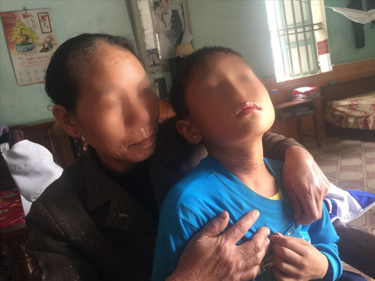 7 giờ kinh hoàng của người mẹ và em trai dưới mũi dao nghịch tử