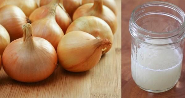 Lấp đầy sẹo lõm trong vài nốt nhạc nếu bạn chịu học hỏi những bí quyết này