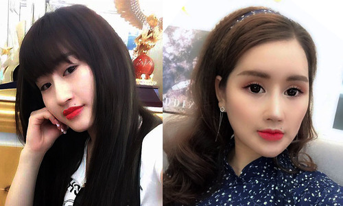Cô gái Hà Nội đập mặt làm lại để xinh như búp bê