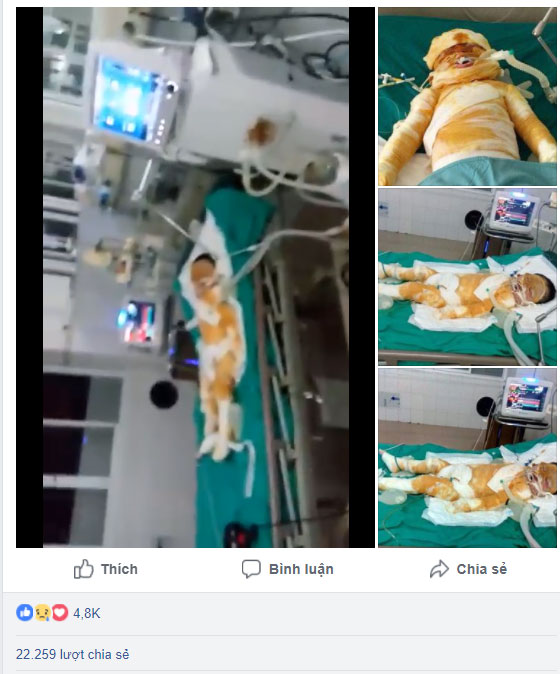 Thái Bình: Chập điện cháy nhà giữa đêm, vợ chồng bỏng nặng, bé gái 4 tuổi nguy kịch