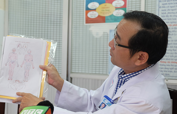 4 nạn nhân vụ nổ khí hầm cầu nhà vệ sinh: Một người bỏng 96% cơ thể, tiên lượng xấu