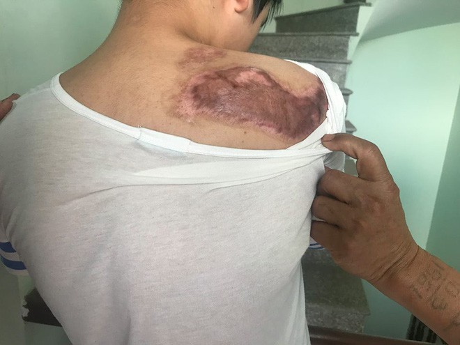 Cậu bé 16 tuổi sống sót sau vụ cháy xưởng bánh kẹo khiến 8 người tử vong ở Hà Nội bây giờ ra sao