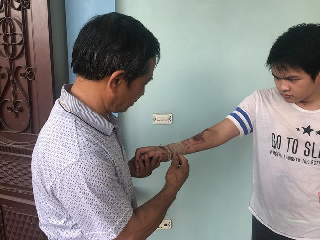 Cậu bé 16 tuổi sống sót sau vụ cháy xưởng bánh kẹo khiến 8 người tử vong ở Hà Nội bây giờ ra sao