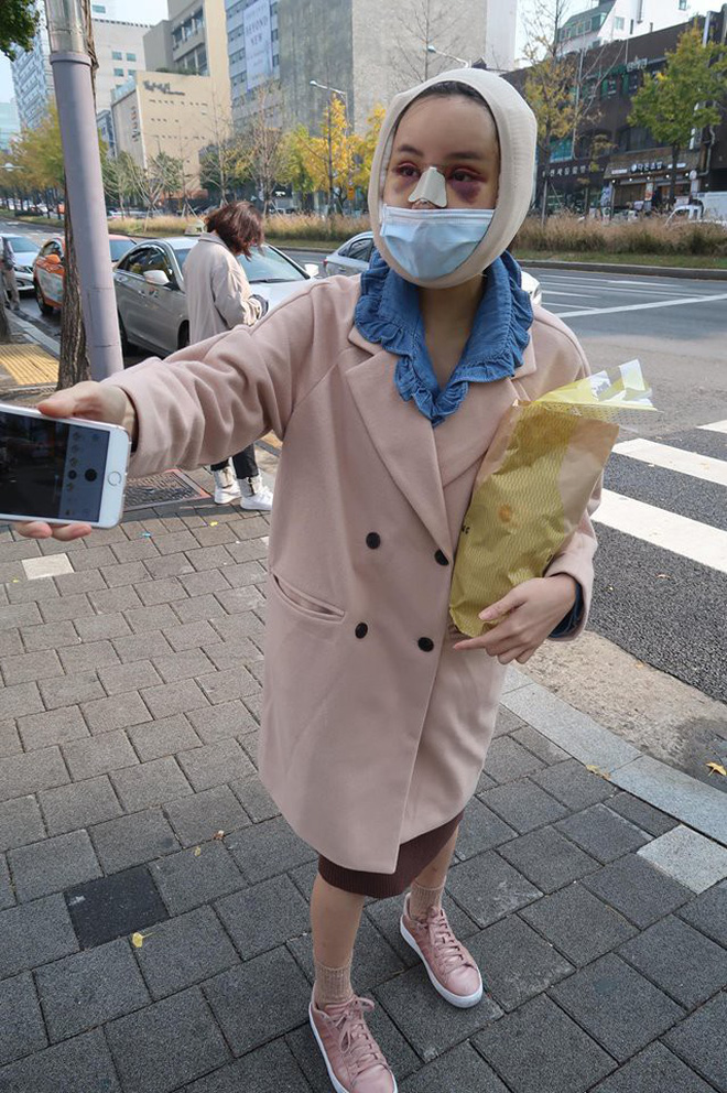 Hot Facebooker Thái Lan bật mí quá trình phẫu thuật thẩm mỹ đau đớn nhưng trả về kết quả đẹp xuất sắc