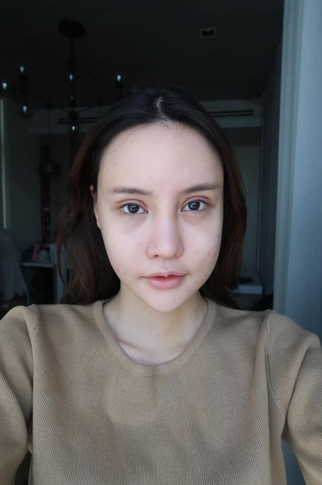 Hot Facebooker Thái Lan bật mí quá trình phẫu thuật thẩm mỹ đau đớn nhưng trả về kết quả đẹp xuất sắc