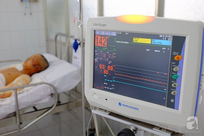 Vụ điện giật khi đang dựng giàn giáo: Một người chết, một người phải đoạn tứ chi