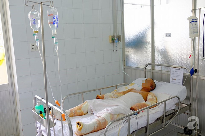 Vụ điện giật khi đang dựng giàn giáo: Một người chết, một người phải đoạn tứ chi