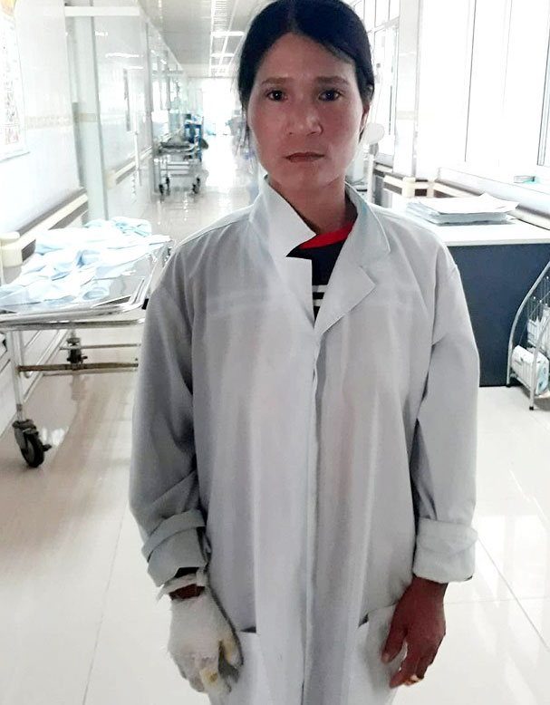 Con ngã vào hố vôi đang sôi, mẹ tuột da, thịt thò tay kéo con lên