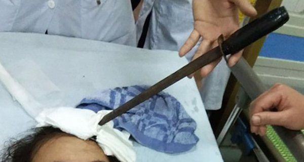 Nam sinh lớp 7 phi dao làm thủng đầu bạn học