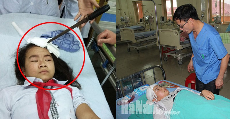 Hà Nam: Nữ sinh bị bạn phi dao trúng người, Bộ yêu cầu xác minh