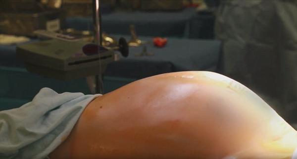 Y học thật kỳ diệu: Thêm một bà mẹ không có tử cung vừa sinh con khỏe mạnh