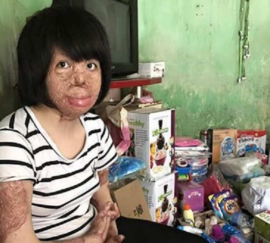2 người phụ nữ bị chồng tẩm xăng đốt nắm tay nhau tô hồng cuộc sống 2 người phụ nữ bị chồng tẩm xăng đốt nắm tay nhau tô hồng cuộc sống
