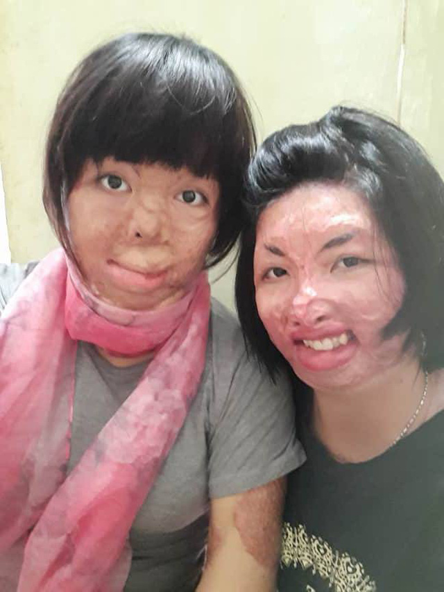 2 người phụ nữ bị chồng tẩm xăng đốt nắm tay nhau tô hồng cuộc sống