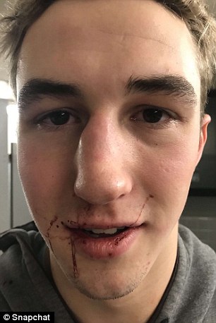 Mỹ: Cô gái xinh đẹp đấm vỡ mũi bạn trai dám chia tay