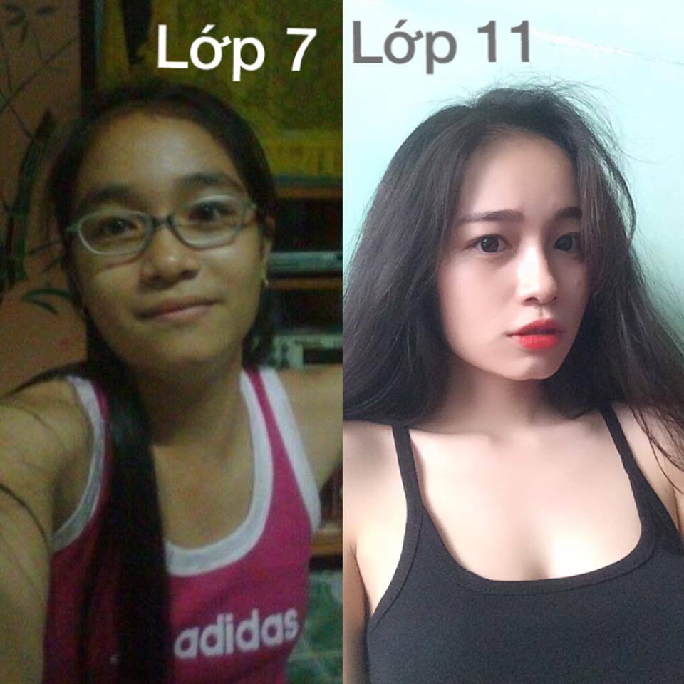 Nữ sinh khoe ảnh dậy thì thành công, tiết lộ bí quyết thay da khiến ai cũng nể