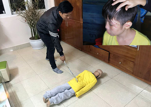 Ông bố hành hạ con trai 10 tuổi bị khởi tố thêm tội danh