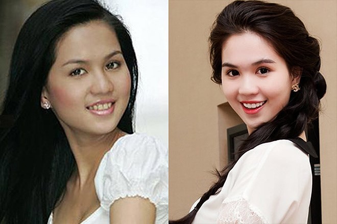 Chỉ cần làm răng, loạt sao Việt đã lên đời nhan sắc thế này!