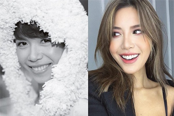 Chỉ cần làm răng, loạt sao Việt đã lên đời nhan sắc thế này!